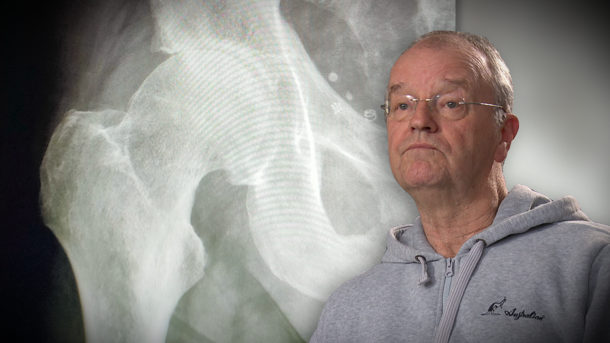 Uitzending: Risicovolle heupoperaties