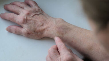 Ouderenmishandeling wordt onvoldoende gemeld. Verschillende experts, zorgprofessionals en wetenschappers spreken hun zorgen uit.