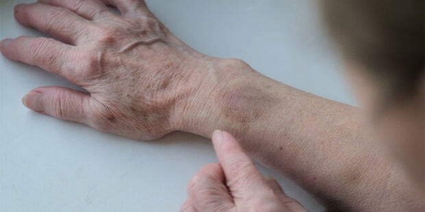 Ouderenmishandeling wordt onvoldoende gemeld. Verschillende experts, zorgprofessionals en wetenschappers spreken hun zorgen uit.